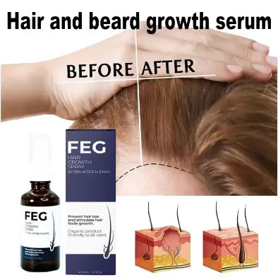 FEG Hair Loss Treatment 50ml